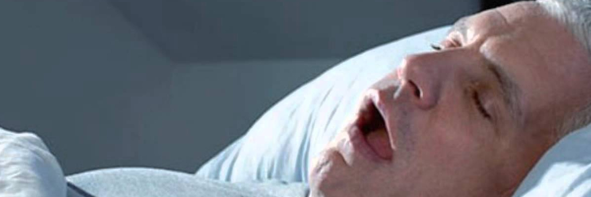 Apnea del sueño, cansancio después de dormir